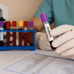 Globulin Blood Test: Normal Range, High & Low Levels, Symptoms and Health Risks Explained